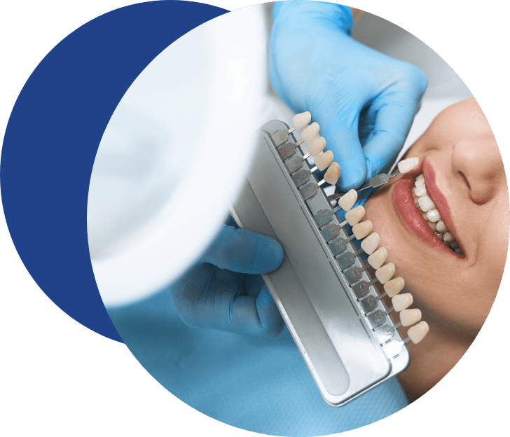 teeth whitening - Tandlægerne Gammel Strand - Group 27 - Teeth Whitening