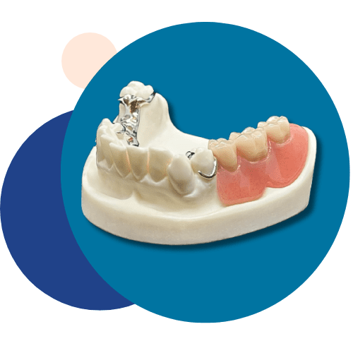Prosthetic Teeth - Tandlægerne Gammel Strand - Design uden navn 6 - Prosthetic Teeth Prosthetic Teeth - Tandlægerne Gammel Strand - Design uden navn 6 - Prosthetic Teeth