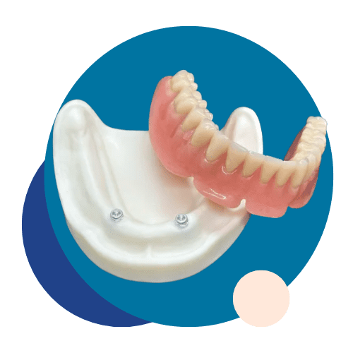 Prosthetic Teeth - Tandlægerne Gammel Strand - Design uden navn 8 1 - Prosthetic Teeth