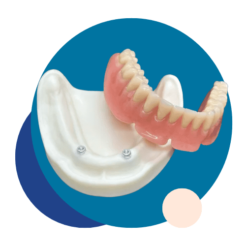 Prosthetic Teeth - Tandlægerne Gammel Strand - Design uden navn 8 1 - Prosthetic Teeth Prosthetic Teeth - Tandlægerne Gammel Strand - Design uden navn 8 1 - Prosthetic Teeth